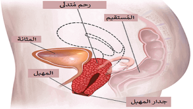 اعراض هبوط الرحم