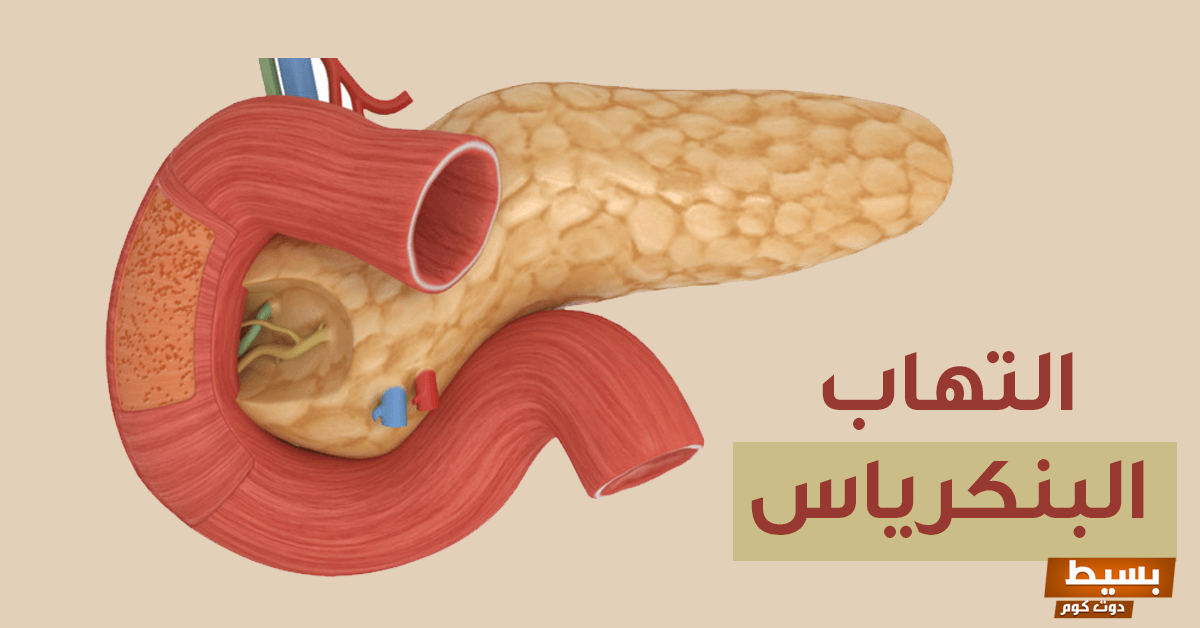 علاج التهاب البنكرياس البسيط